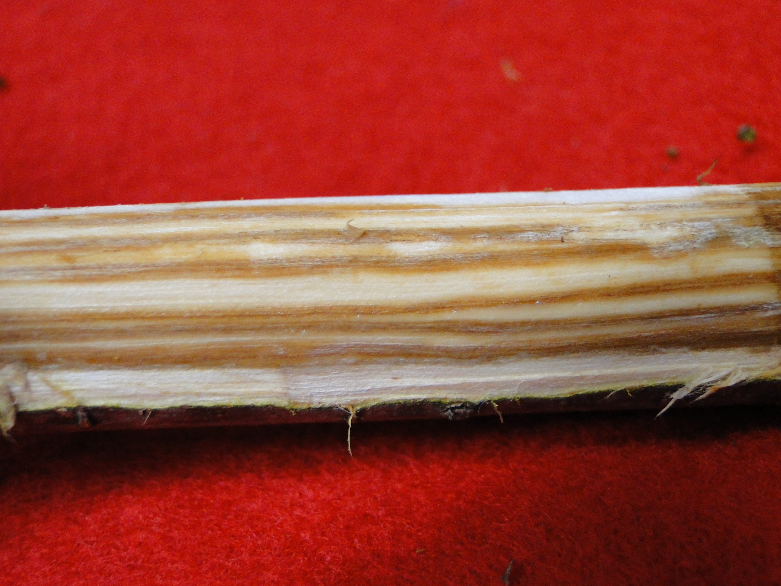  Dutch elm disease with discoloration of vascular tissues