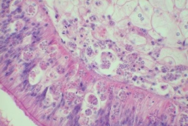 oyster pathology tissue