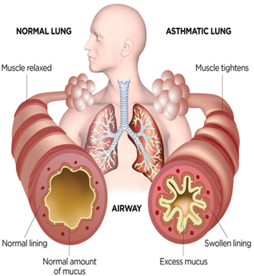 Lungs
