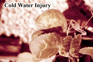 Picture of Cold water injury